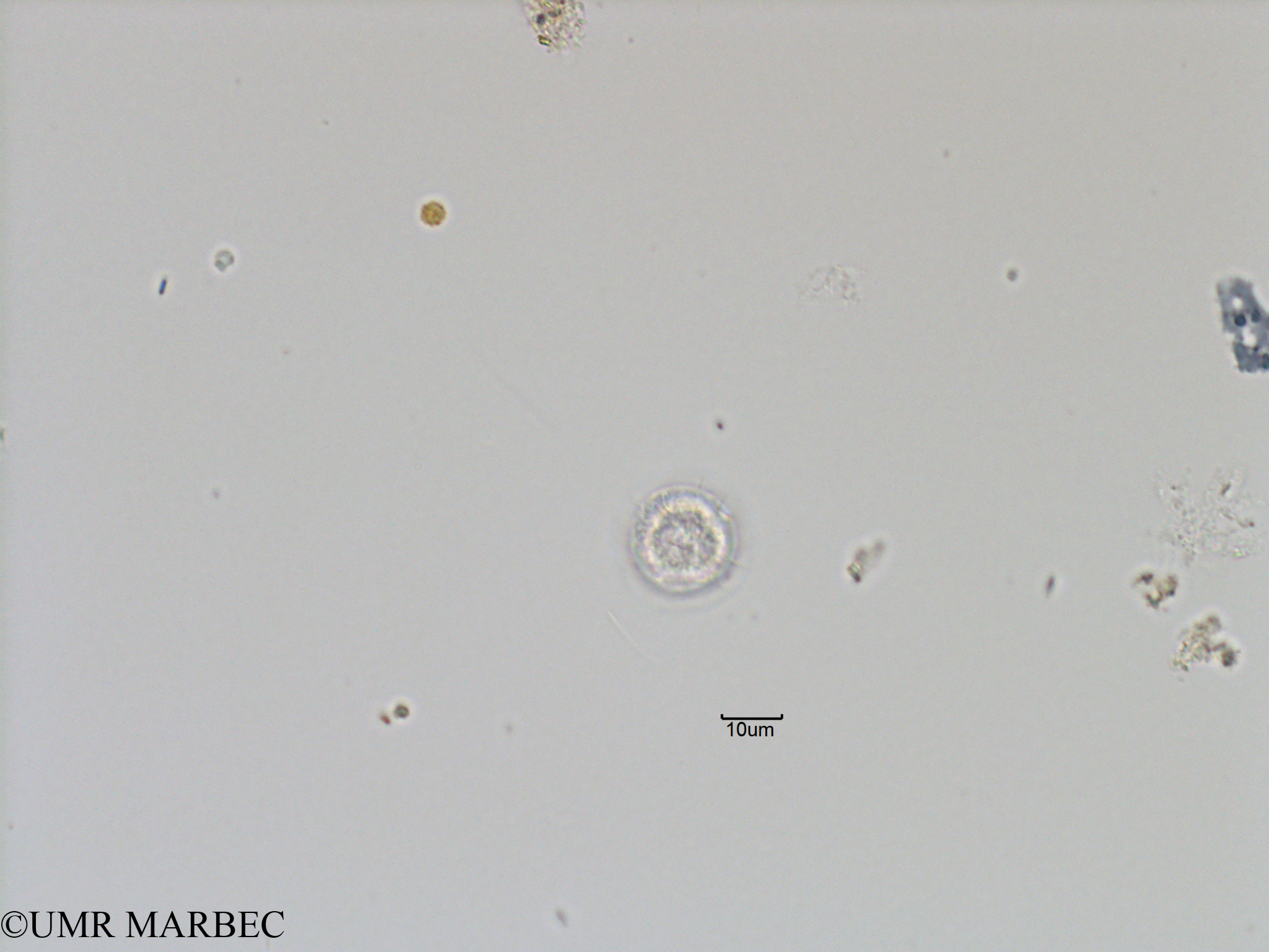 phyto/Bizerte/bizerte_bay/RISCO November 2015/Protoperidinium parcum (Baie_T5-C1-Dino3 ou Proto-1).tif(copy).jpg